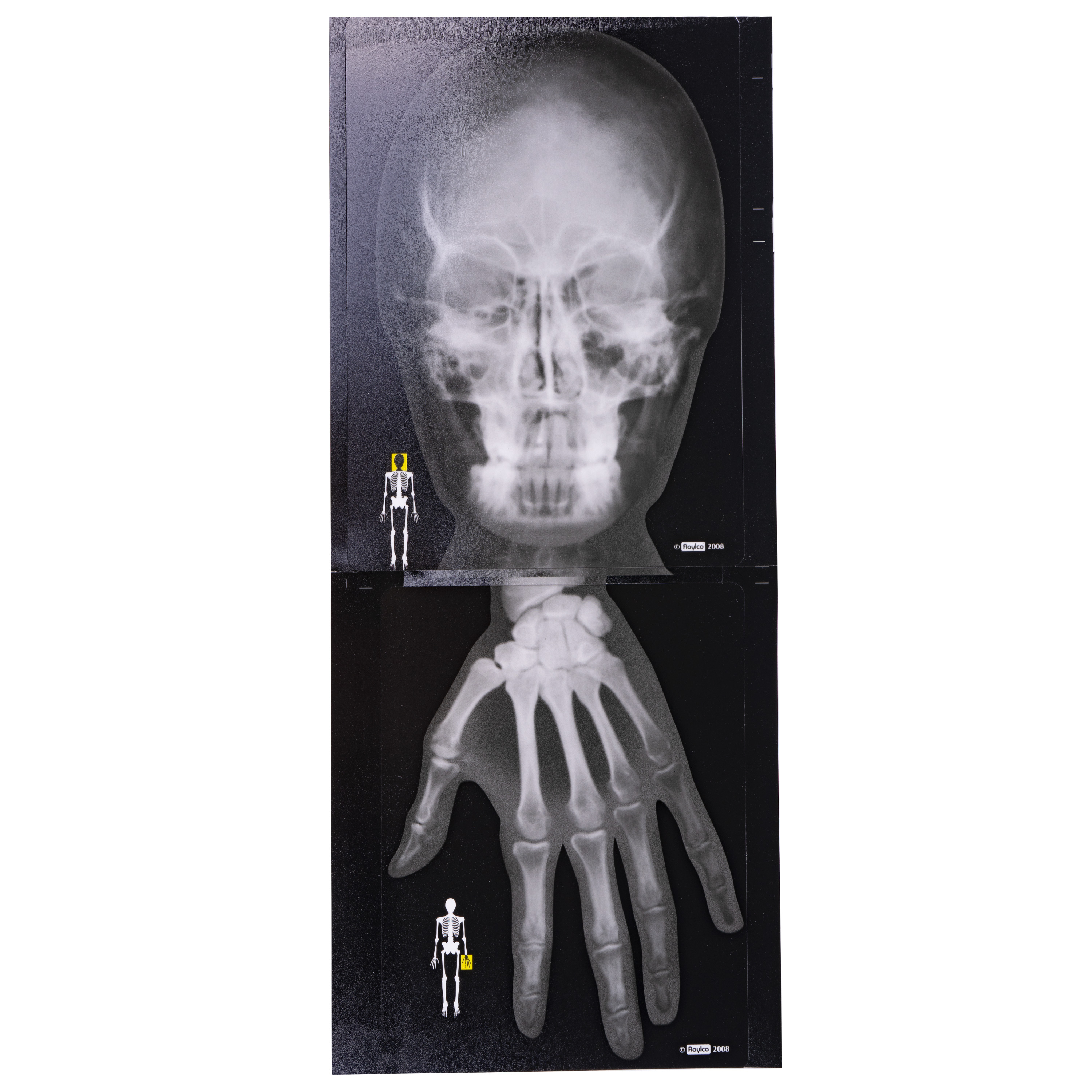 Röntgenbilder 'Mensch', 18 Stück