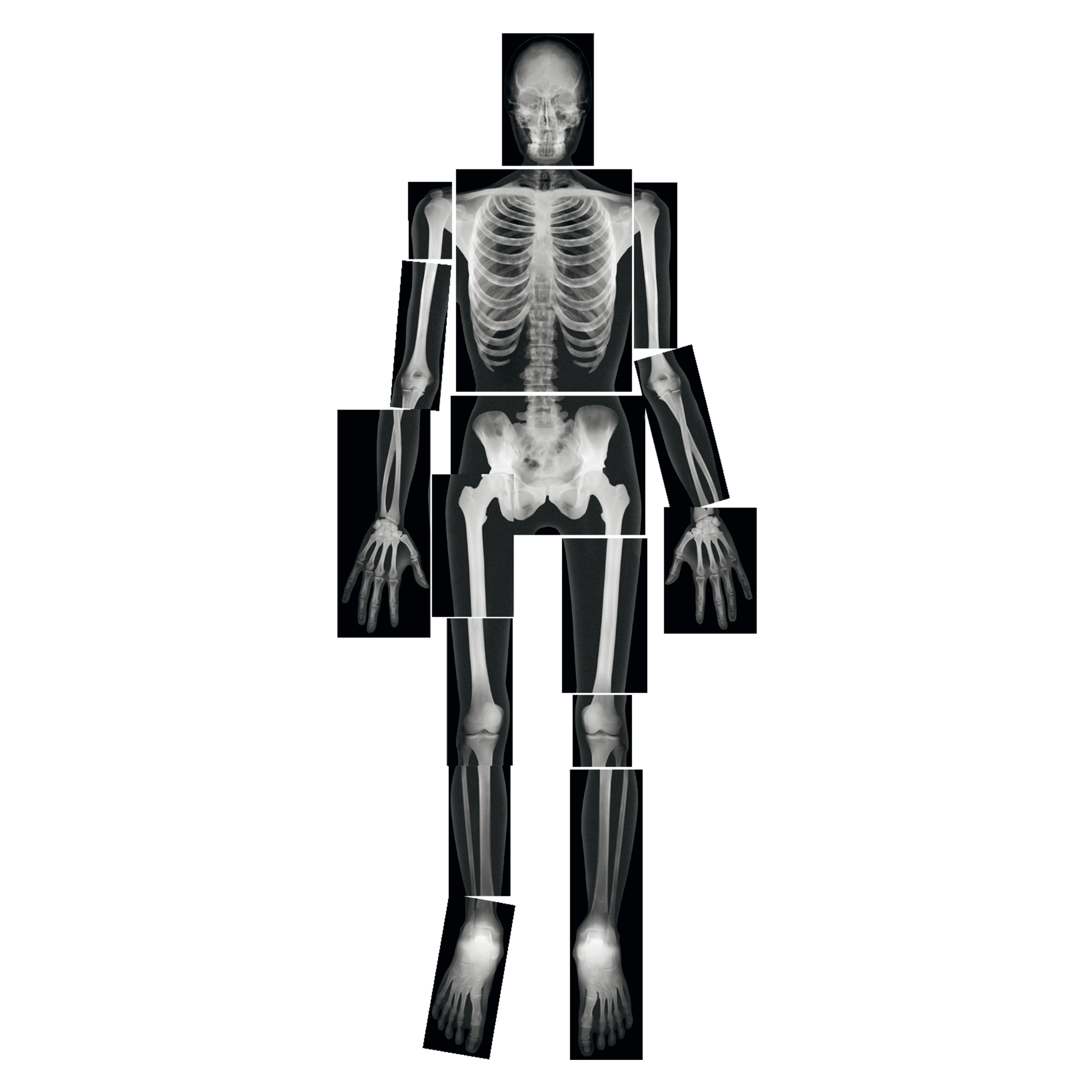 Röntgenbilder 'Mensch', 18 Stück